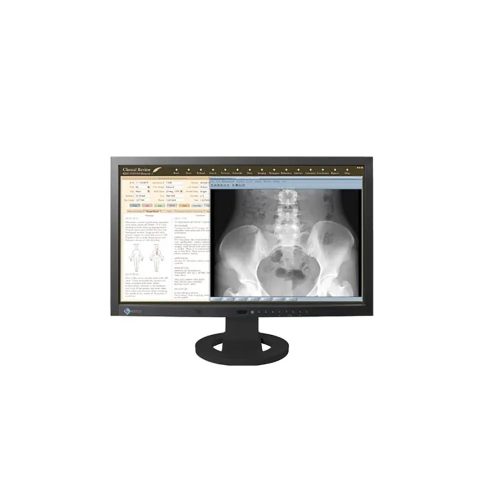 EIZO RadiForce MS230W / 23 inch / 1920x1080 használt monitor